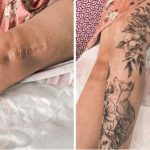 Scars that were once famous are now beautiful tattoos